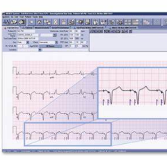 iCV net心電信息管理系統(tǒng)
