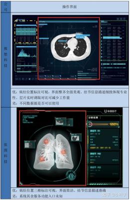 肺結節(jié)CT影像輔助檢測軟件Yitu_AICare_CT_Chest