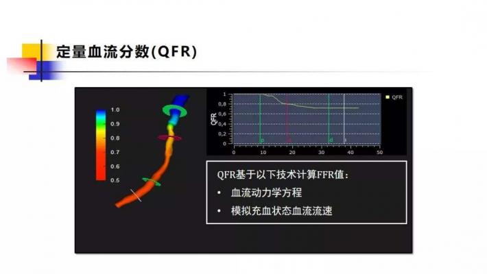 定量血流分?jǐn)?shù)測量軟件AngioPlus Core