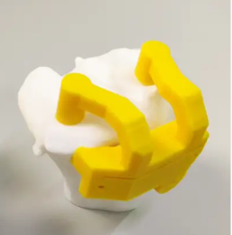 膝關節(jié)截骨個性化手術導板htopm-a廠家